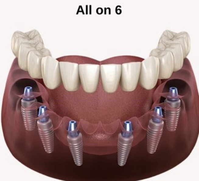 deal image 1