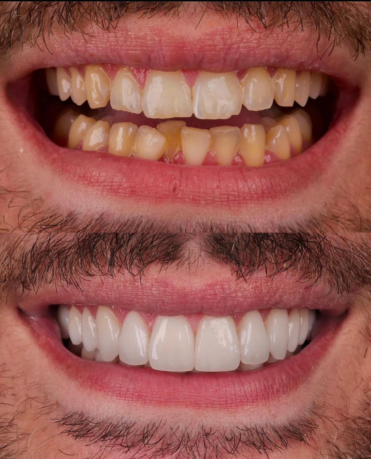 deal image 2