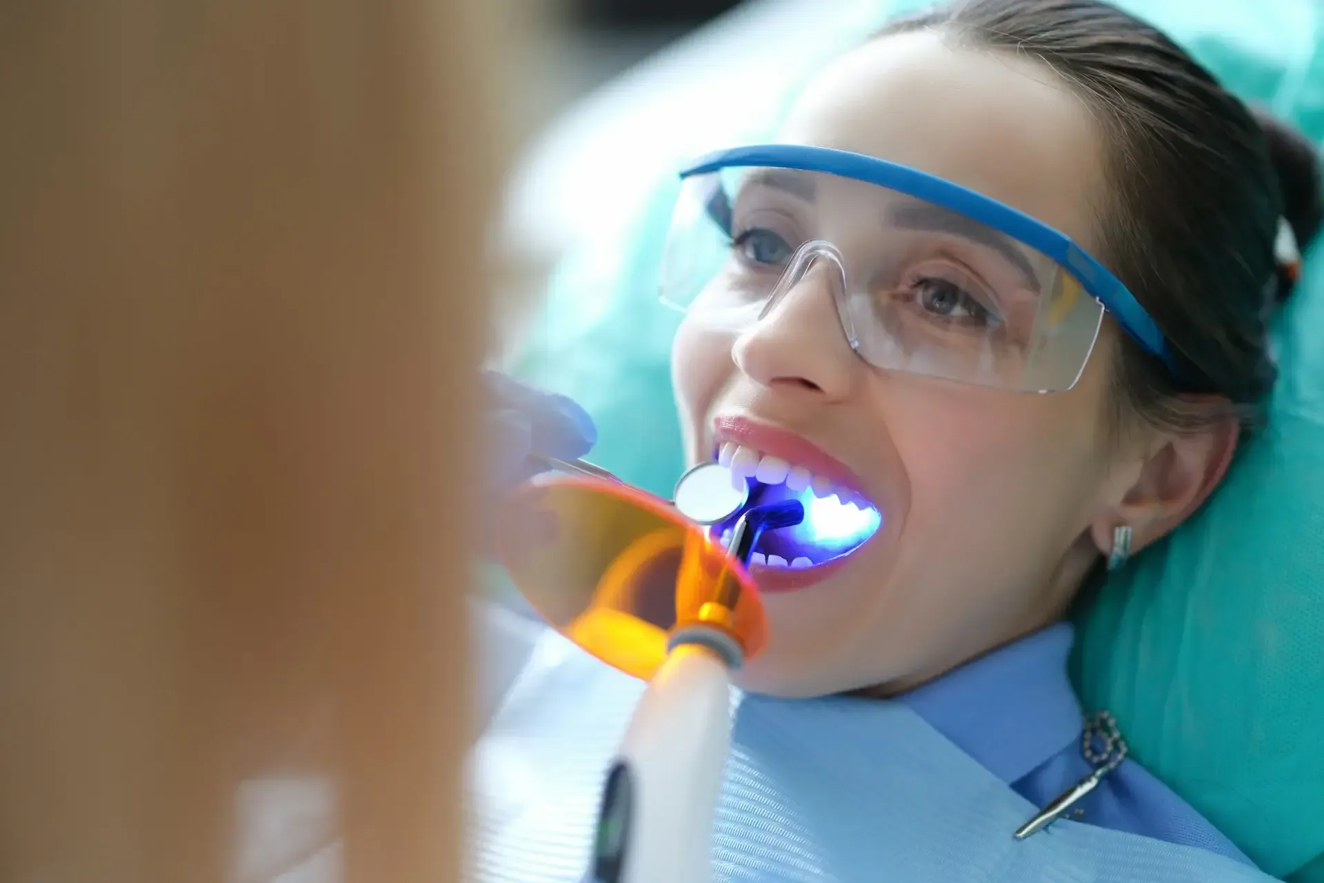 how much does dental bonding cost