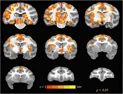 ketamine therapy for depression
