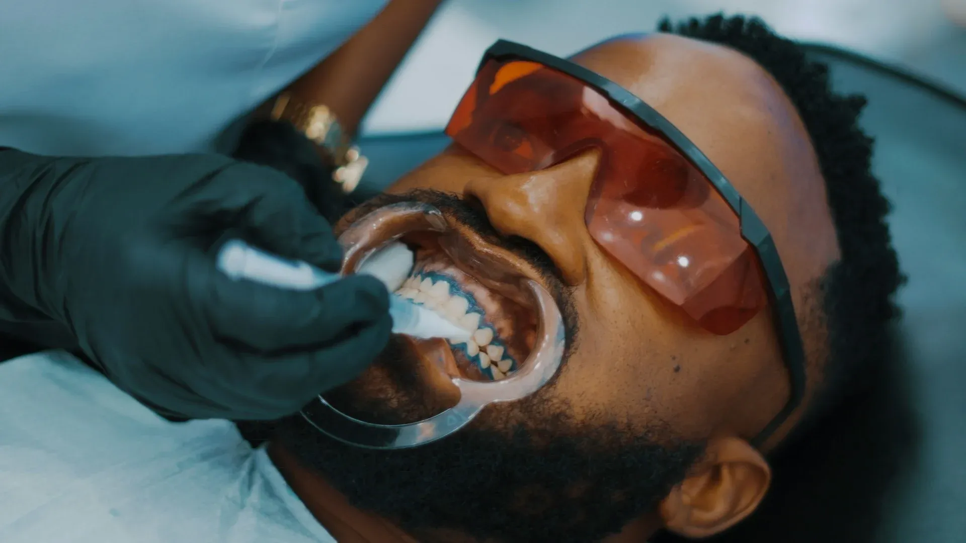 teeth whitening in turkey